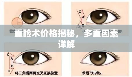 重睑术价格揭秘，多重因素详解