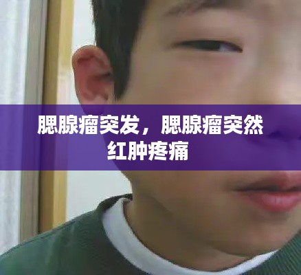 腮腺瘤突发，腮腺瘤突然红肿疼痛 